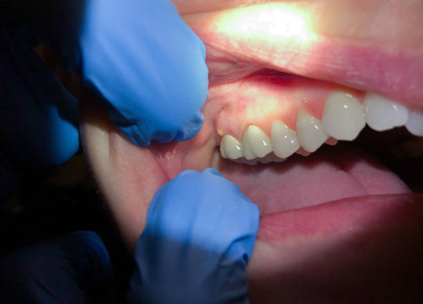 Best Cracked Tooth Emergency Dentist  in Warren Af, WY