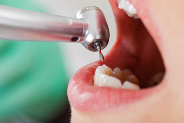  Warren Af, WY Emergency Dentist Pros